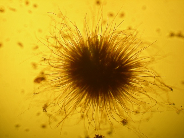 1.2. ábra. Gloeotrichia echinulata (Cyanobacteria, Nostocales rend) faj, mely a jó fényviszonyokkal rendelkező, kisebb tavakban fordul elő